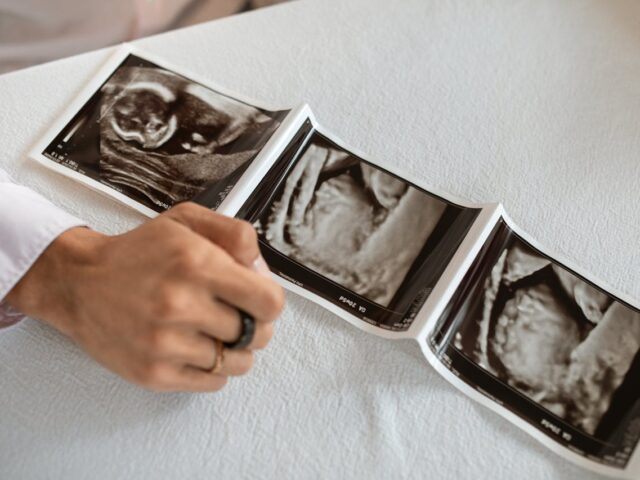 Alles wat je wilt weten over hoeveel weken zwanger je bent